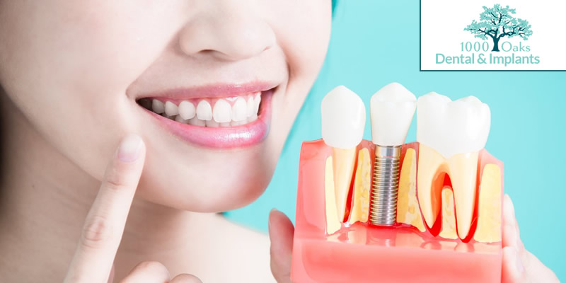 Gum Disease (Gingivitis & Periodontitis) Know The Symptoms, Causes & Treatment